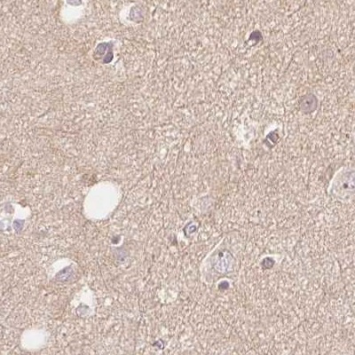 WDR54 Antibody in Immunohistochemistry (IHC)