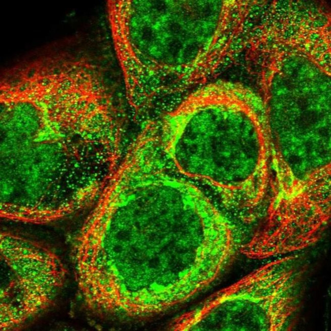 C19orf24 Antibody in Immunocytochemistry (ICC/IF)