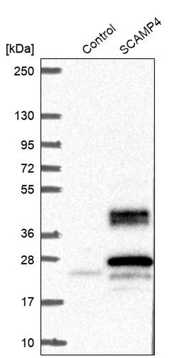 SCAMP4 Antibody in Western Blot (WB)