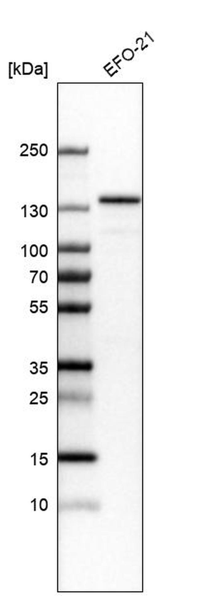 JMY Antibody in Western Blot (WB)