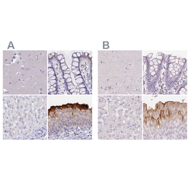 UPK2 Antibody in Immunohistochemistry (IHC)