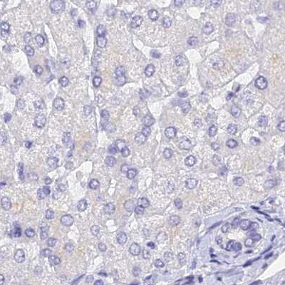 UPK2 Antibody in Immunohistochemistry (IHC)