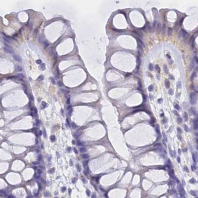 UPK2 Antibody in Immunohistochemistry (IHC)