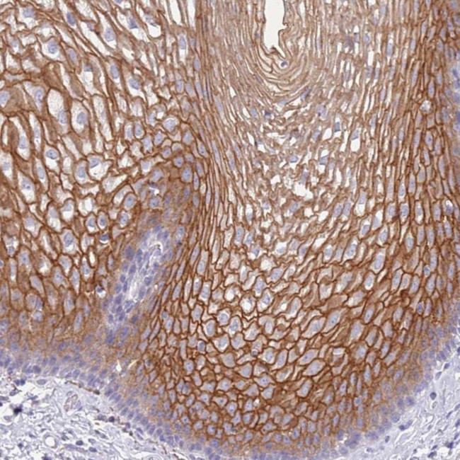 RHCG Antibody in Immunohistochemistry (IHC)