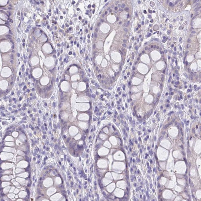 RHCG Antibody in Immunohistochemistry (IHC)