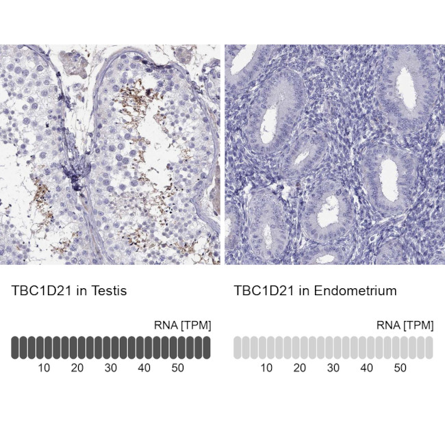 TBC1D21 Antibody in Immunohistochemistry (IHC)