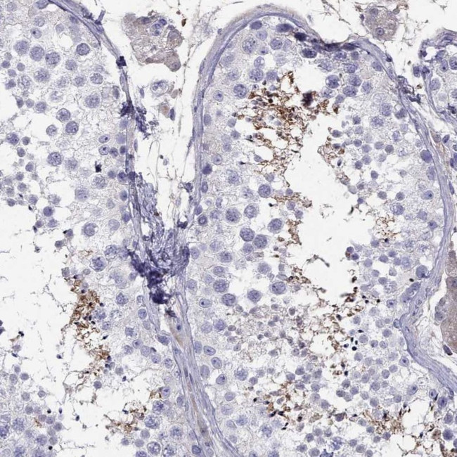 TBC1D21 Antibody in Immunohistochemistry (IHC)