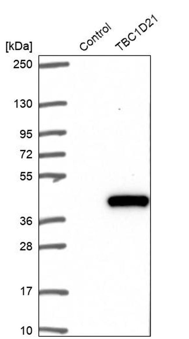 TBC1D21 Antibody in Western Blot (WB)