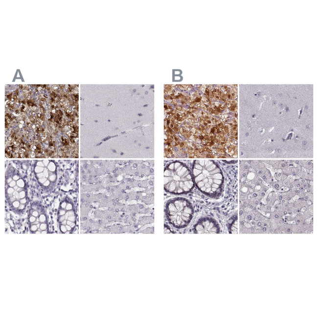 PNMT Antibody in Immunohistochemistry (IHC)