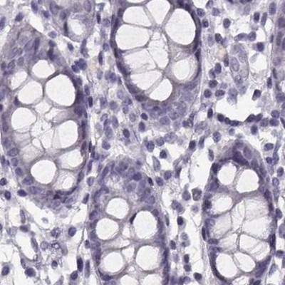 PNMT Antibody in Immunohistochemistry (IHC)