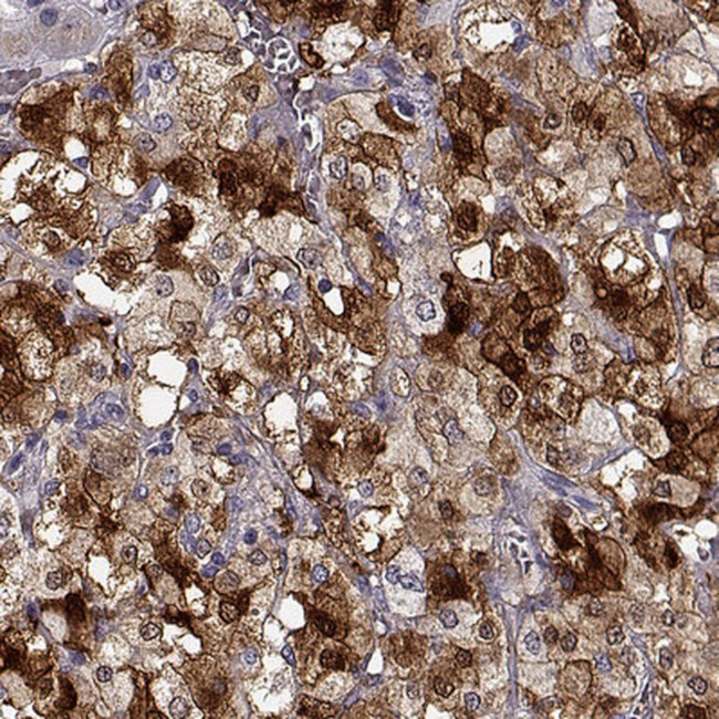 PNMT Antibody in Immunohistochemistry (IHC)