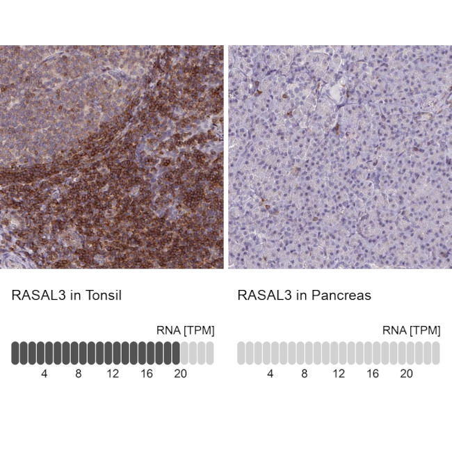 RASAL3 Antibody in Immunohistochemistry (IHC)