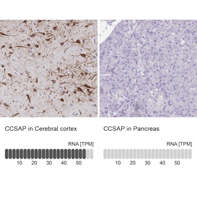 C1orf96 Antibody in Immunohistochemistry (IHC)