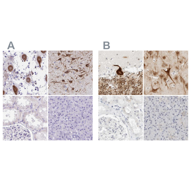 C1orf96 Antibody in Immunohistochemistry (IHC)