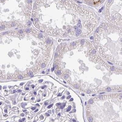 C1orf96 Antibody in Immunohistochemistry (IHC)