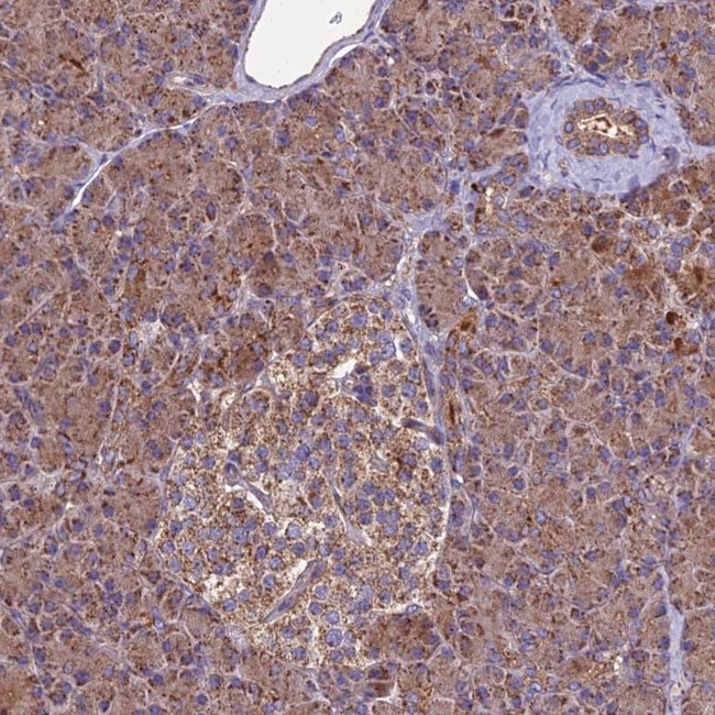 MRPS9 Antibody in Immunohistochemistry (IHC)