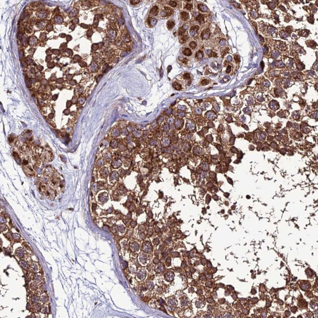 MRPS9 Antibody in Immunohistochemistry (IHC)