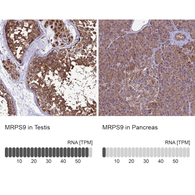 MRPS9 Antibody