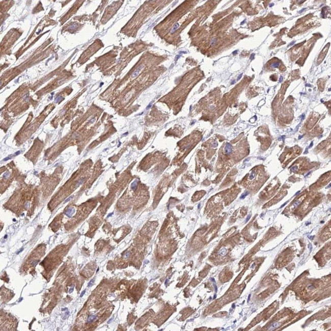 MRPS9 Antibody in Immunohistochemistry (IHC)