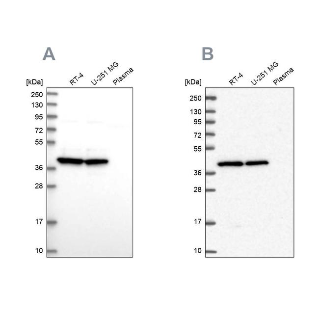 MRPS9 Antibody in Western Blot (WB)