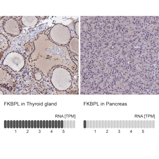 FKBPL Antibody in Immunohistochemistry (IHC)