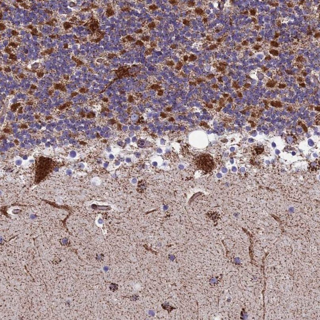 MRPS18B Antibody in Immunohistochemistry (IHC)