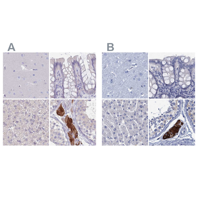 CYP51A1 Antibody in Immunohistochemistry (IHC)