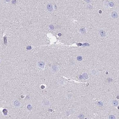 CYP51A1 Antibody in Immunohistochemistry (IHC)