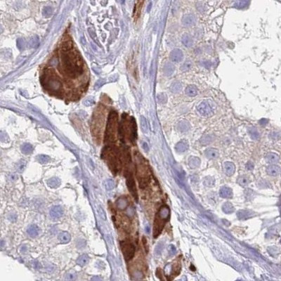 CYP51A1 Antibody in Immunohistochemistry (IHC)