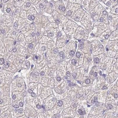 CYP51A1 Antibody in Immunohistochemistry (IHC)