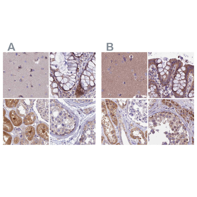 DUS2L Antibody in Immunohistochemistry (IHC)