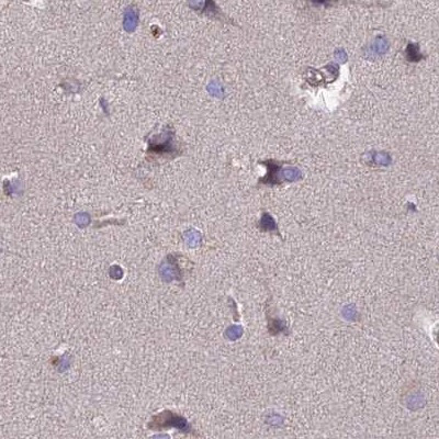 DUS2L Antibody in Immunohistochemistry (IHC)