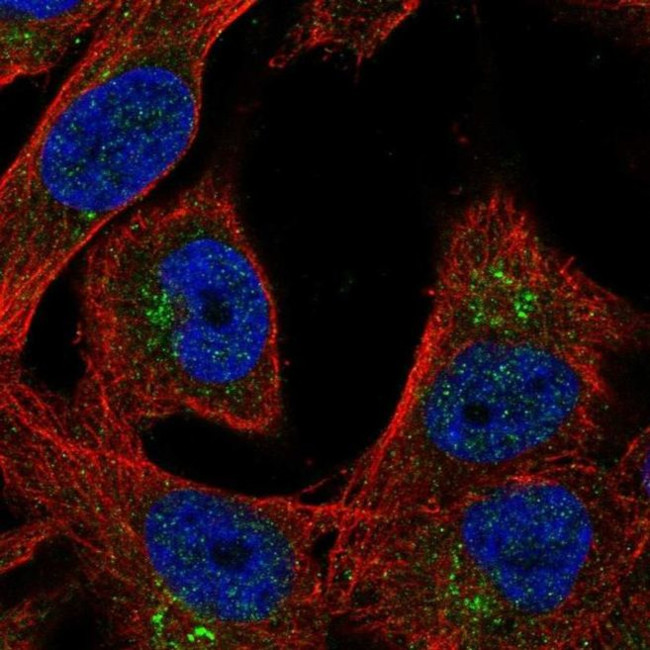 LGI4 Antibody in Immunocytochemistry (ICC/IF)