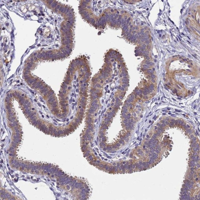 LGI4 Antibody in Immunohistochemistry (IHC)