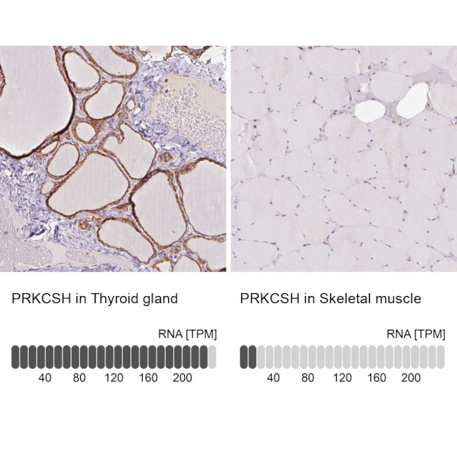 PRKCSH Antibody in Immunohistochemistry (IHC)