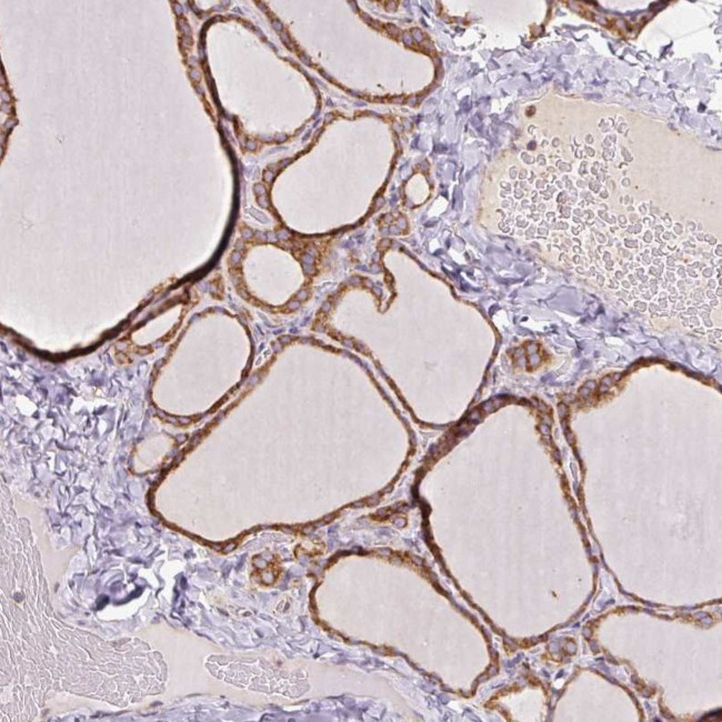 PRKCSH Antibody in Immunohistochemistry (IHC)