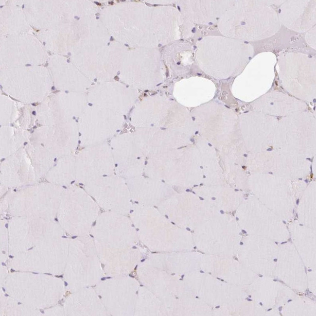 PRKCSH Antibody in Immunohistochemistry (IHC)