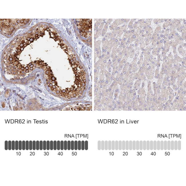 WDR62 Antibody in Immunohistochemistry (IHC)