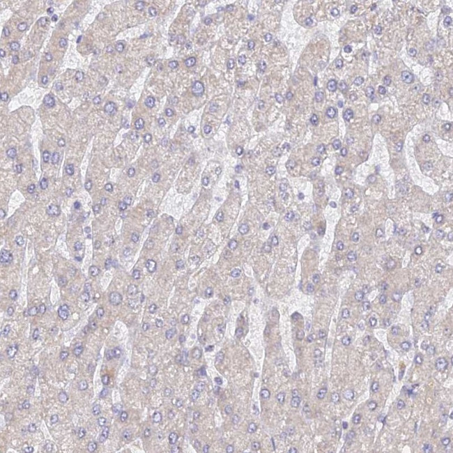 WDR62 Antibody in Immunohistochemistry (IHC)