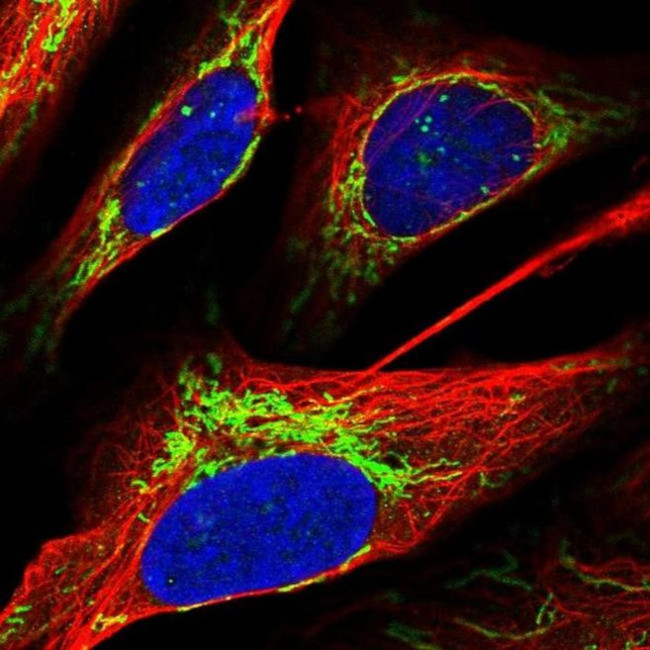 ACOT1 Antibody in Immunocytochemistry (ICC/IF)