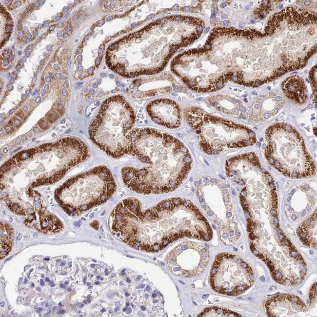 ACOT1 Antibody in Immunohistochemistry (IHC)