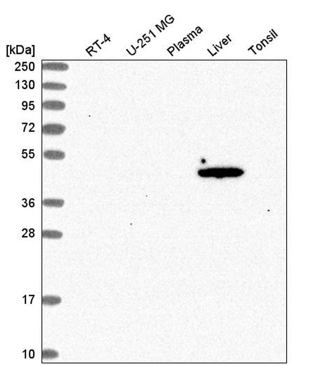 ACOT1 Antibody in Western Blot (WB)