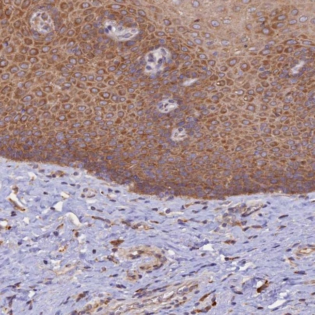 RPL5 Antibody in Immunohistochemistry (IHC)