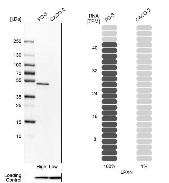 LPXN Antibody in Western Blot (WB)