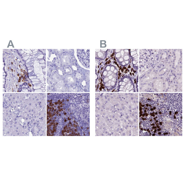 MZB1 Antibody in Immunohistochemistry (IHC)