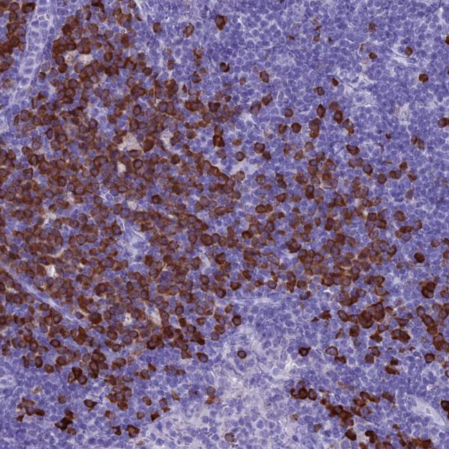 MZB1 Antibody in Immunohistochemistry (IHC)