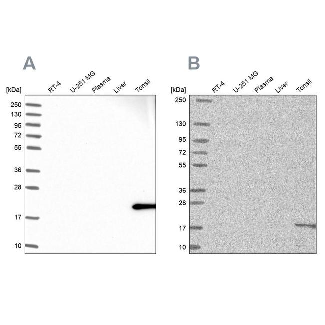 MZB1 Antibody in Western Blot (WB)