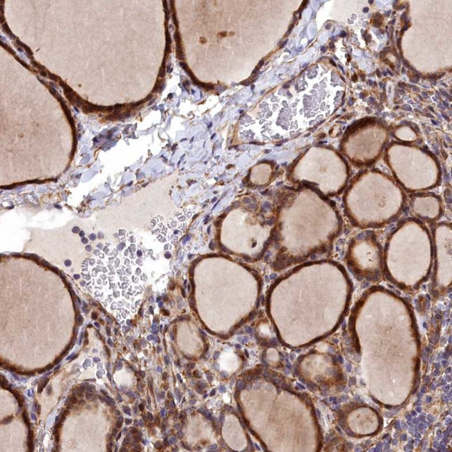 MRPS11 Antibody in Immunohistochemistry (IHC)