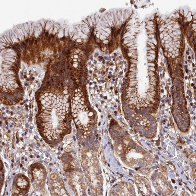 MRPS11 Antibody in Immunohistochemistry (IHC)