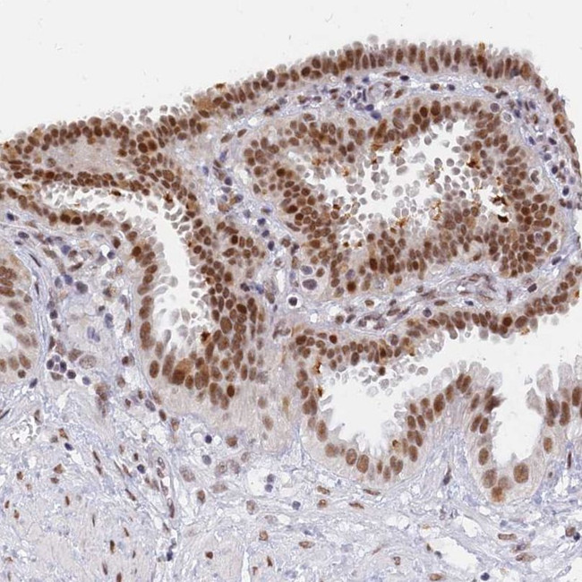 DPY30 Antibody in Immunohistochemistry (IHC)